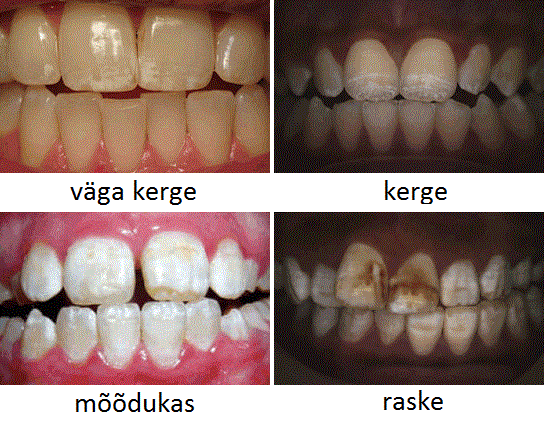 Эрозивный флюороз фото