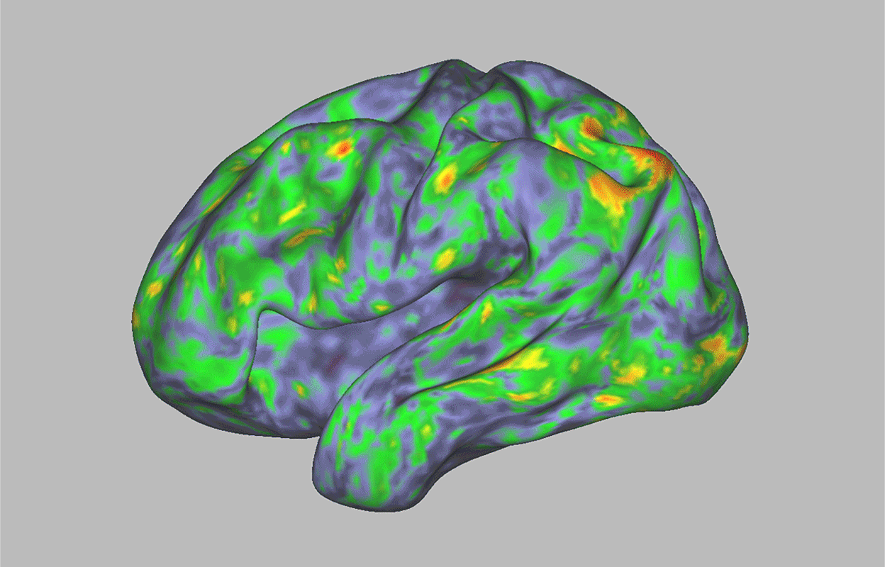 Creierul tău într-o călătorie cu ciuperci – Cum psilocibina resetează rețelele neuronale